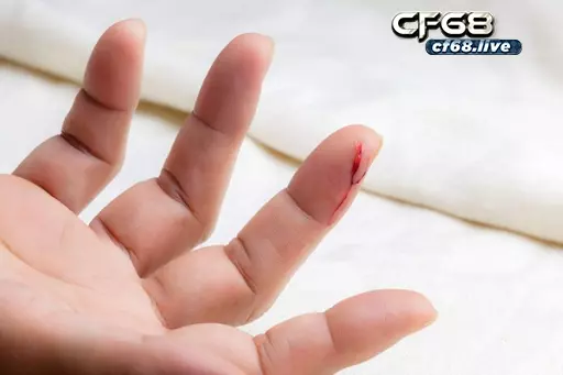 Giải mã giấc mơ bị chảy máu đánh con gì cùng cf68 Gặp hiện tượng bị chảy máu đánh con gì