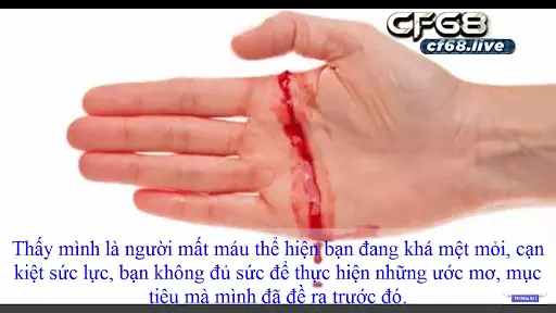 Giải mã giấc mơ bị chảy máu đánh con gì cùng cf68 Ngủ mơ thấy bị chảy máu đánh con gì?