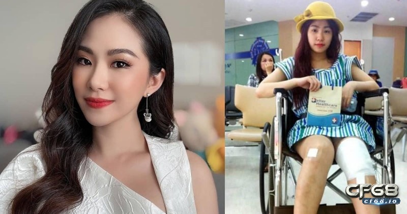 Tiểu sử Lương Bích Hữu cập nhật mới nhất năm 2022 Sự cố phỏng nặng ở mặt và chân ảnh hưởng sự nghiệp