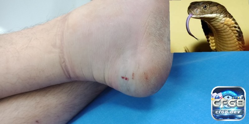 Mơ thấy rắn cắn: Giải mã ý nghĩa và những con số liên quan Mơ thấy rắn cắn gót chân người quen là cảnh báo về các mối quan hệ hiện tại
