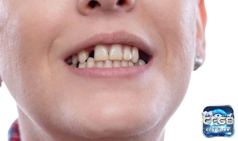 Mơ thấy rụng răng là điềm báo gì? Giải mã các con số may mắn Mơ thấy rụng răng nhưng không đau cho thấy bạn đang trải qua những thay đổi nhẹ nhàng mà không gây ra quá nhiều căng thẳng.