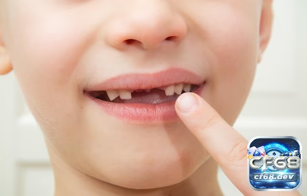 Mơ thấy rụng răng là điềm báo gì? Giải mã các con số may mắn Mơ thấy rụng răng cửa là dấu hiệu bạn đang lo lắng về việc mất đi vị thế, sự tự tin hoặc sức hút của bản thân.