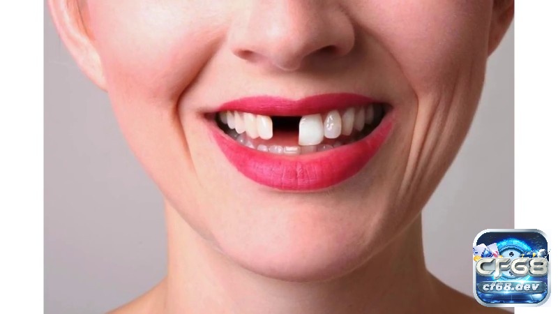 Nằm mơ thấy rụng răng điềm báo gì? Điềm báo lành hay gỡ? Mơ rụng răng mang đến cảm giác tiêu cực, ảnh hưởng mạnh mẽ đến suy nghĩ của bạn.